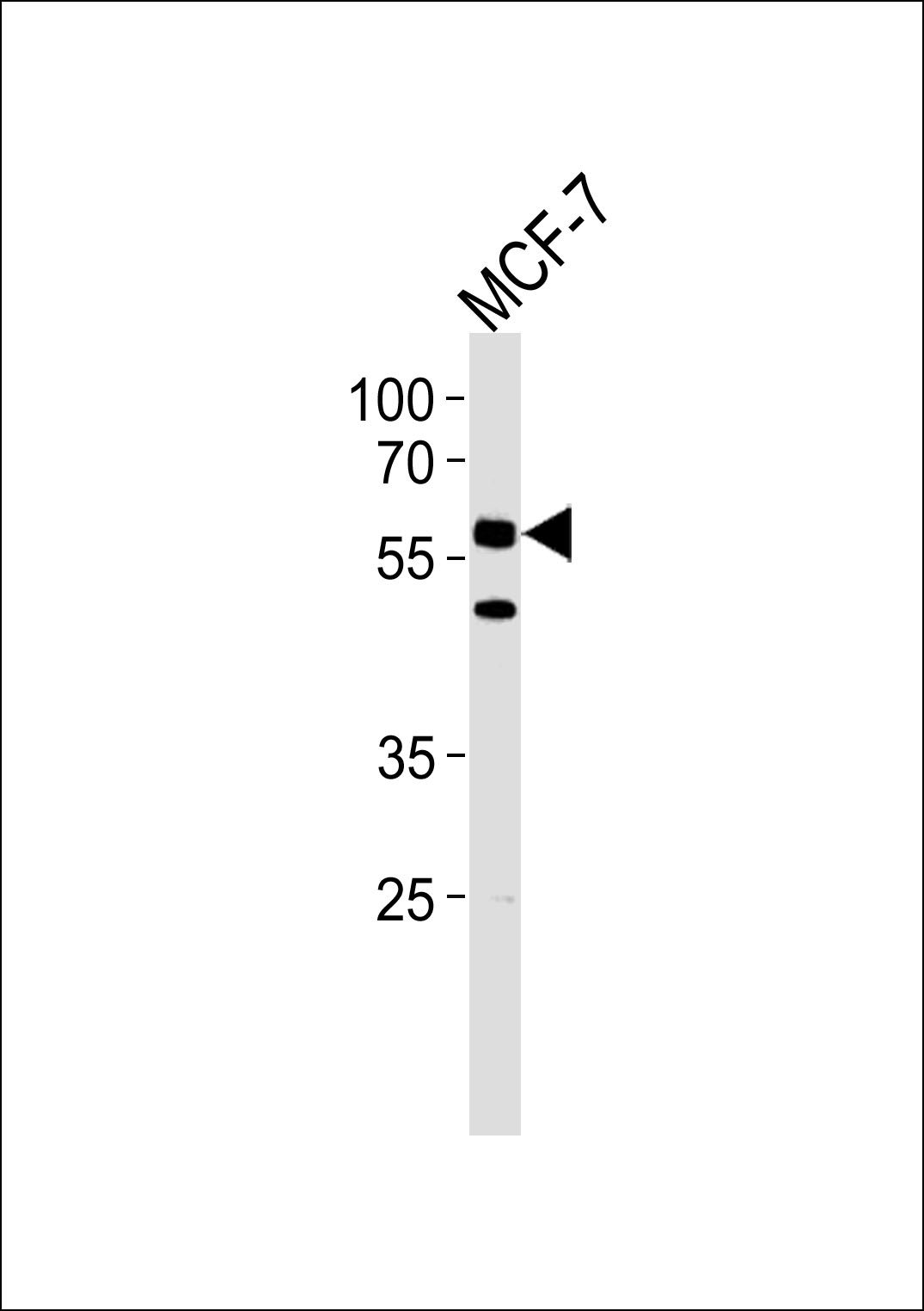 WB - CDC7 (CDC7L1) Antibody (N-term) AP7515a